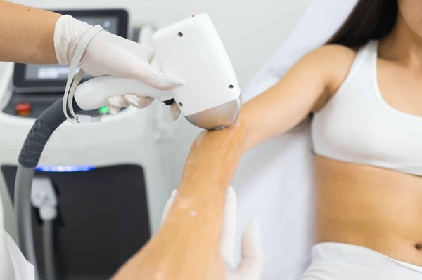 Un centre d'épilation laser qui fait révolutionne votre peau à Marseille